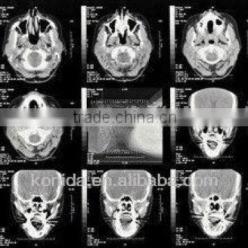 agfa digital film,medical x-ray image intensifier,t4 diagnostic