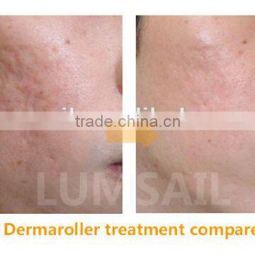 Professional Derme Roller 1.5mm Micro Needle Roller Dermaroller Derma Roller Titanium photo-4