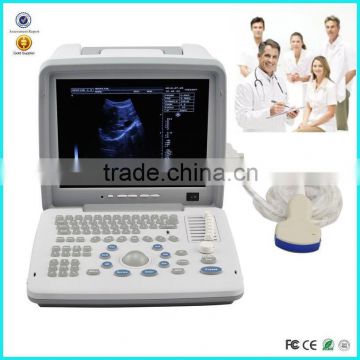 2016 Cheapest Portable Ultrasounic Diagnosis Scanner Machine System with Convex/ Linear Phased Array Transducer and Sony Printer