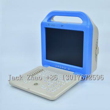 Portable Color Doppler Laptop Ultrasound, Dw-C60 Ultrasonic Machine photo-4