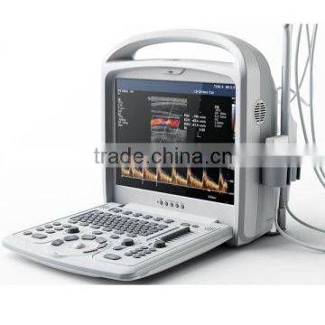 Protable 2D Color Doppler FM-9200T/ Portable color doppler