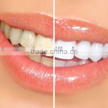 The magic tooth whitening pen