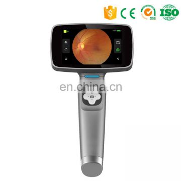 MY-V038-N Digital Non-mydryatic Portable Fundus Camera Handheld Retina Camera Ophthalmic Equipment