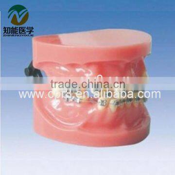 Teeth model (orthodontics) BIX - L1029