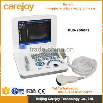 Carejoy Ultrasound Machine portable Ultrasound Scanner with multi frequency probe for hospital clinics community RUS-9000F2