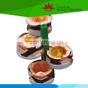Most popular Medical teaching human Asthma model