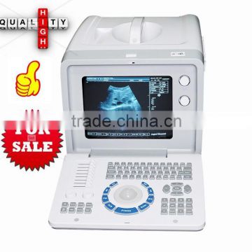 CE Medical Device Portable Hospital Clinic Ultrasound Medical Diagnose Scanner/Machine With Probe Transducer-Shelly