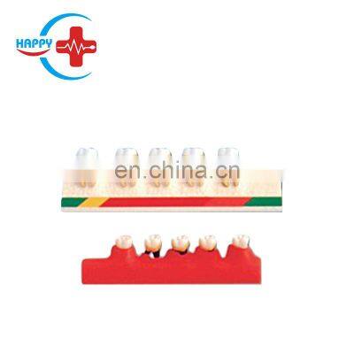 HC-S410 High Quality Dental Periodontal disease classification model, teeth disease model for teaching