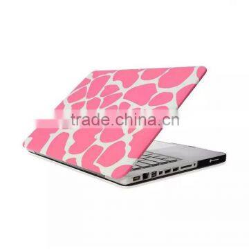 New Printing Custom Design Case Cover for macbook pro 15" with 13 Colors