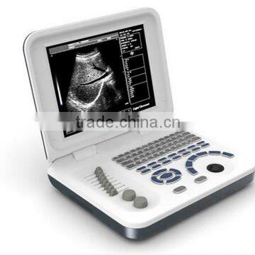 low price Portable Ultrasound machine, mini laptop Ultrasound Scanner