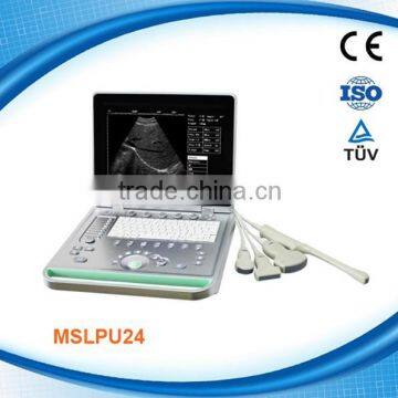 Hot sale Laptop ultrasound scanner MSLPU24-M