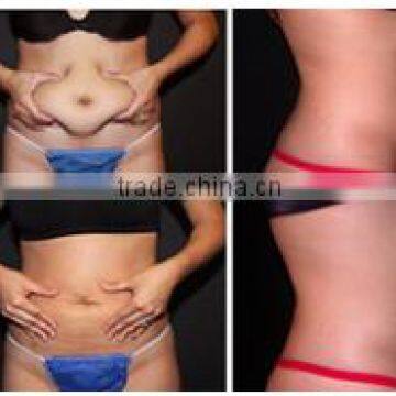 5 in 1 Lost Weight Explosive Speed Grease Cavitation Slimming System photo-6