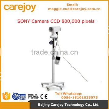 CE ISO approved Digital Video Electronic Colposcope SONY Camera CCD 800,000 pixels with PC software