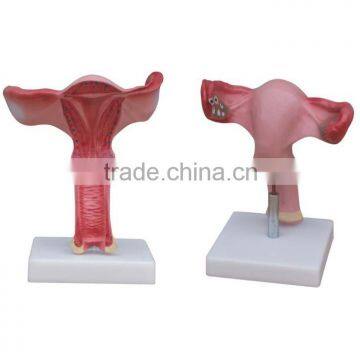 uterus model