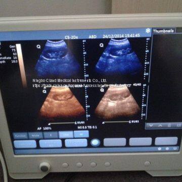 15'' Touch Screen High Resolution Portable Ultrasound Scanner Ultrasonic Diagnostic Device With Multi-frequency Probes photo-3