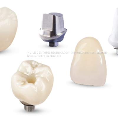 Implant Crowns & Bridges China Outsourcing Dental