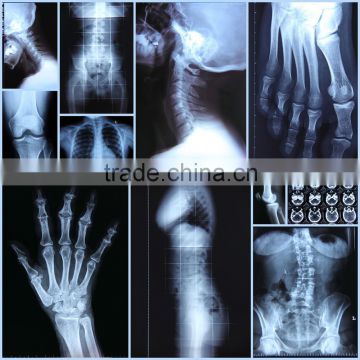 x-ray blue film, fuji dry film,ct scan film for medical equipment in china