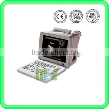 MSLPU01 cheap portable ultrasound machine