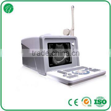 Hospital professional portable B Mode Ultrasound scanner equipped 3.5Mhz convex probe