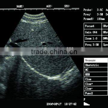 Best Vet Ultrasound Scanner for Cow photo-6