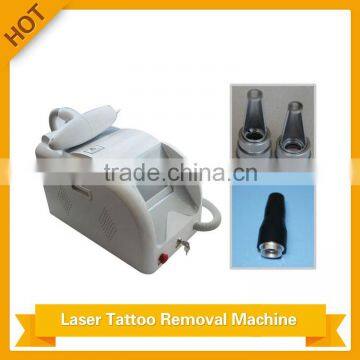 nd yag laser tattoo removal portable blackhead removal