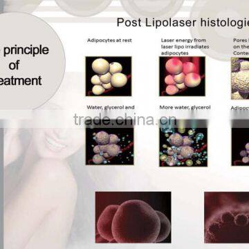 Lipolaser Slimming Machine photo-3