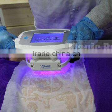 Cellulite Reduction CE Certificated Skin Protection Antifreeze Membrane For Lipo Cryo Machine Double Cryolipolysis In Reduce Cellulite photo-6