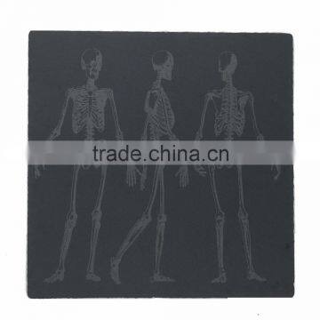 [factory direct] 10"X10"Natural Laser Slate Plate Item CP-25P425P4SD2A-2