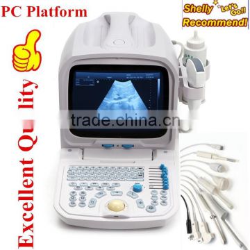 Medical Equipment Portable Diagnose/Cheapest ultrasound Scanner/Machine for Veterinary and Human