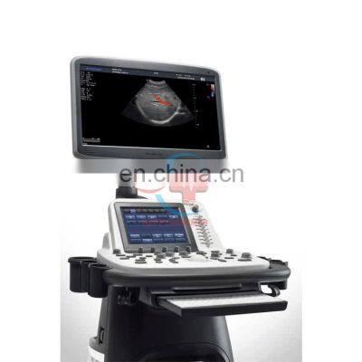 New Design 4D Trolley Color Doppler Ultrasound Machine Sonoscape s22 Ultrasound Scanner