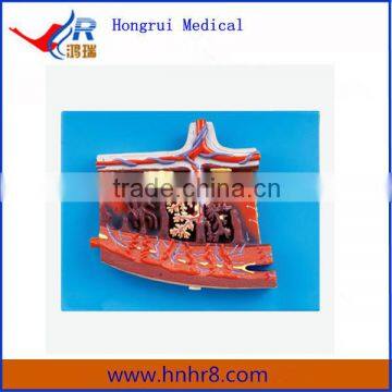 Hot Sale Enlarged Model of Placenta