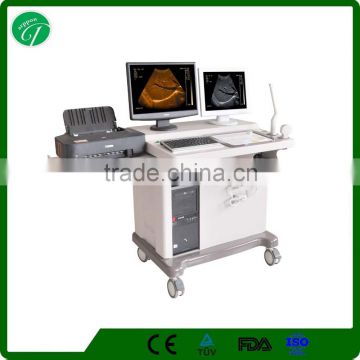 portable ultrasound / 4D ultrasound machine / 4d/3d/2d ultrasound scanner With printer2018CIV