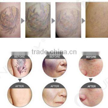 Hot Selling 1064nm Long Pulse Laser Big Power photo-6