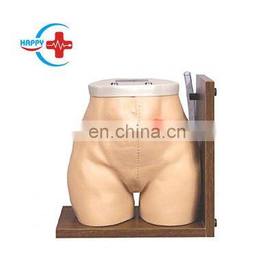 HC-S136 Medical Science Fistula Colostomy Anatomical Simulation/Human Nursing Training Model