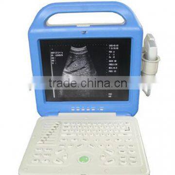 AJ-6100B LCD Portable Pseudo Color US ultrasound scanner china