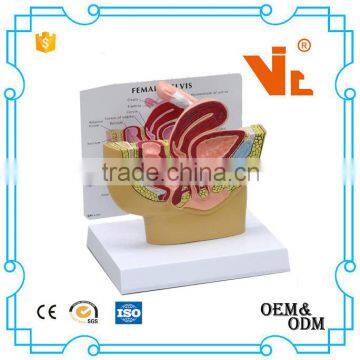 V-AM033 PVC Female pelvic cavity anatomical model for teaching