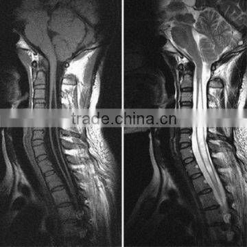 Medical radiology x-ray dry film