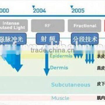 Deep Wrinkle Removal Hifu High Intensity Focus Ultrasound Hifu Wrinkle Removal Machine Pigment Removal