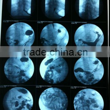 Fuji dry film, konida medical equipment, medical x-ray film