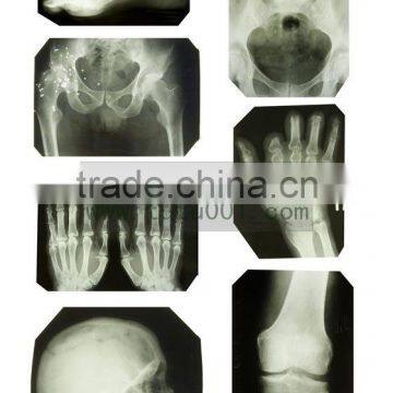China radiology films KND-A/F CE
