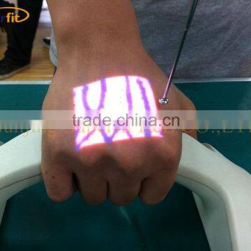Nurses And Doctor Displaying Veins In Screen Vascular Imager Infrared Vein Finder SBF-1000 photo-3