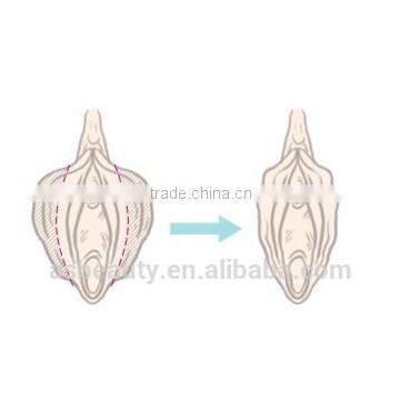 CO2 Fractional Laser Vaginal Tightening/laser Stretch Mark Removal Vaginal Rejuvenation Equipment Face Whitening