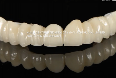 Elite Zirconia (Porcelain Fused To Zirconia) Crown China Dental Laboratory