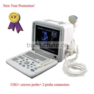 Promotion!CE approved Notebook B-Mode Ultrasound Scanner with 3.5Mhz multi-frequency convex probe RUS-9000B