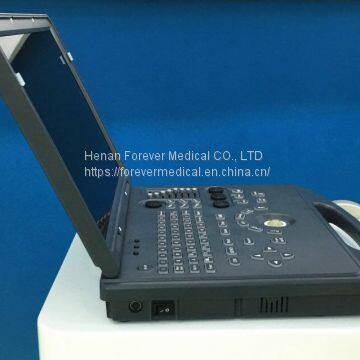 Color Doppler Pregnancy Scanner Ultrasound Machine photo-2