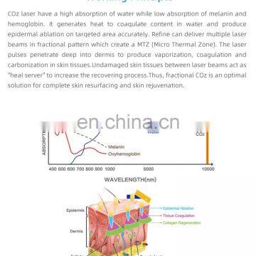 GSD 30W Fractional CO2 Laser Facial Beauty Machine Vaginal Tightening Facial Beauty Equipment photo-5