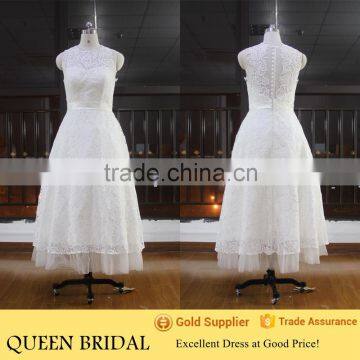 Real Works Appliqued Short Lace Wedding Dress Patterns 2016