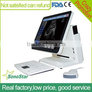 Sonostar Portable Ultrasound Color Doppler Low Prices Of Ultrasound Machine