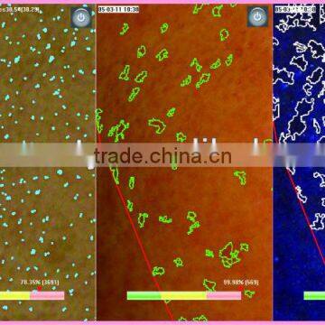 WT-03-B Big Facial Skin Analyzer Magic Mirror photo-4
