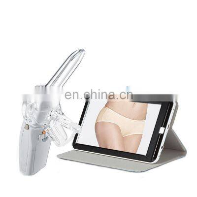 Vaginal Self-Exam Colposcope Digital Video Colposcope Gynecological Mini-Colposcope photo-2